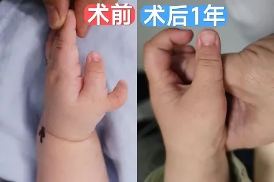 info-1080-720 info-1080-720